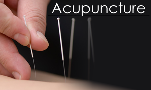 Image result for Acupuncture Tips That Can Help You Know What To Expect
